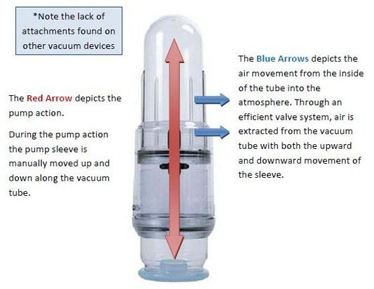 A Comprehensive Guide to Using Vacurect Safely and Effectively for Erectile Dysfunction